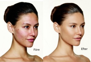 bareMinerals blemish remedy foundation before and after